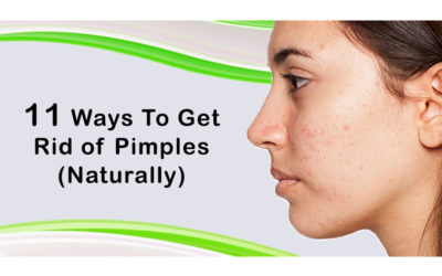 Pimple Rid Tips