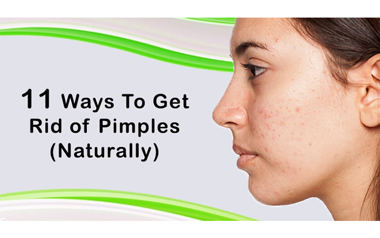 how to get rid of pimples