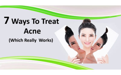 Acne Treatment
