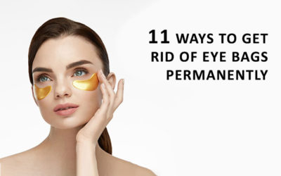 How to Get Rid of Eye Bags?