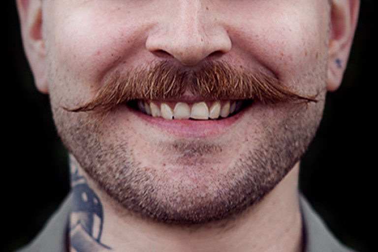 The Benefits and Risks of Moustache Hair Transplant