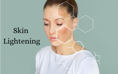 Skin Lightening: Understanding the Treatment Options