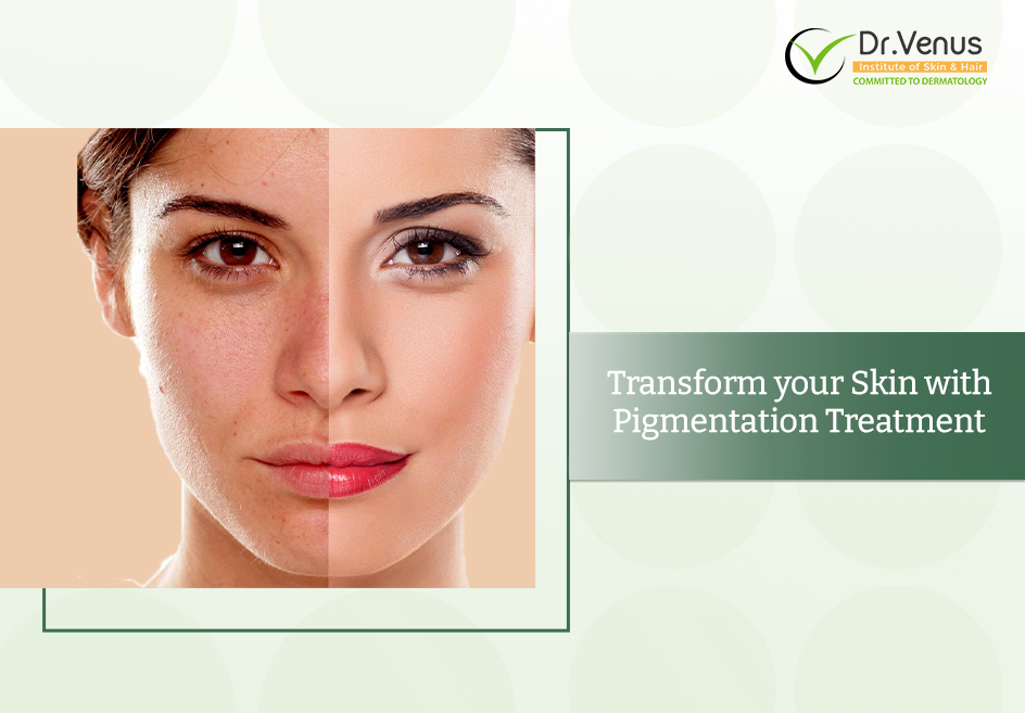 Freckles to Fabulous: Transform your Skin with Pigmentation Treatment