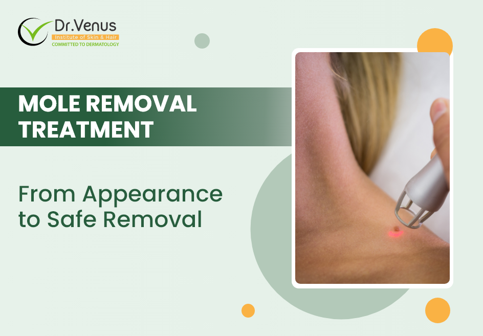Mole removal treatment