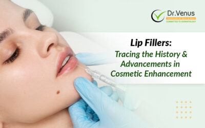 Lip Fillers: Tracing the History and Advancements in Cosmetic Enhancement